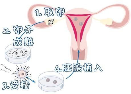 槿棠生殖中心环境